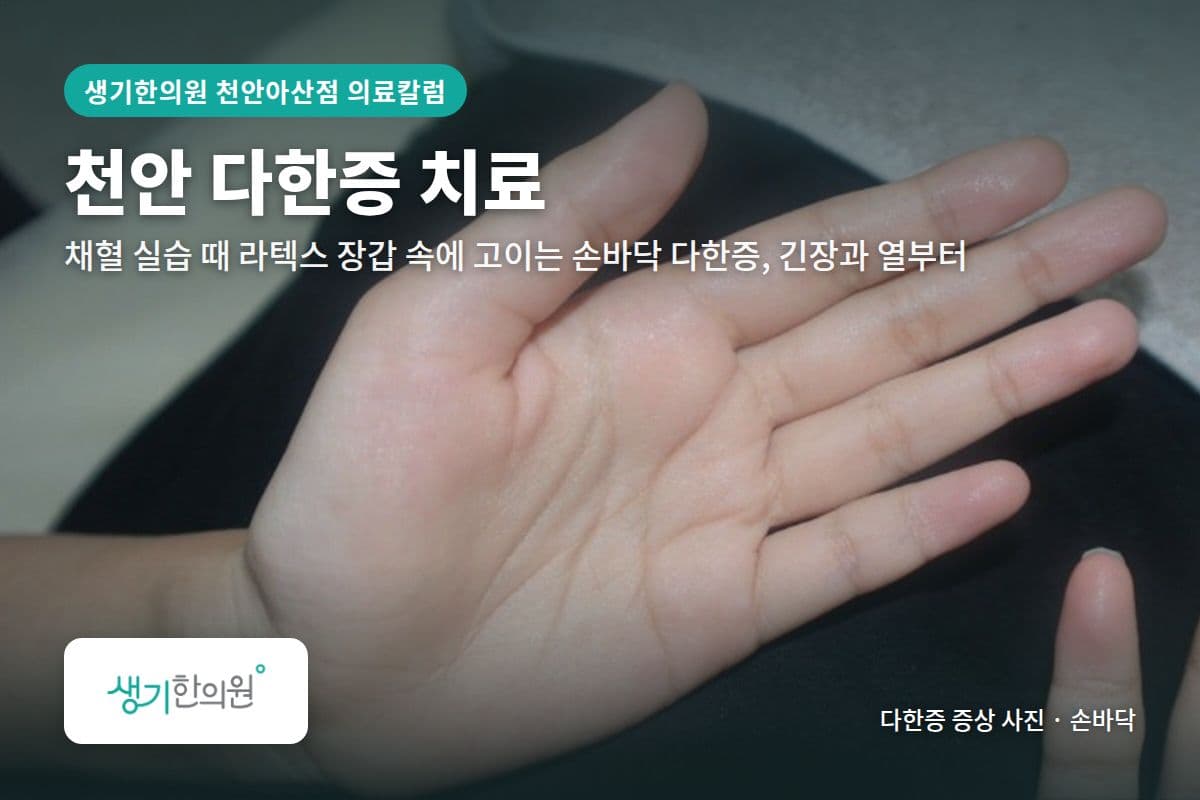 손바닥 다한증 증상 사진과 문구 「천안 다한증 치료, 채혈 실습 때 라텍스 장갑 속에 고이는 손바닥 다한증, 긴장과 열부터 · 생기한의원 천안아산점」