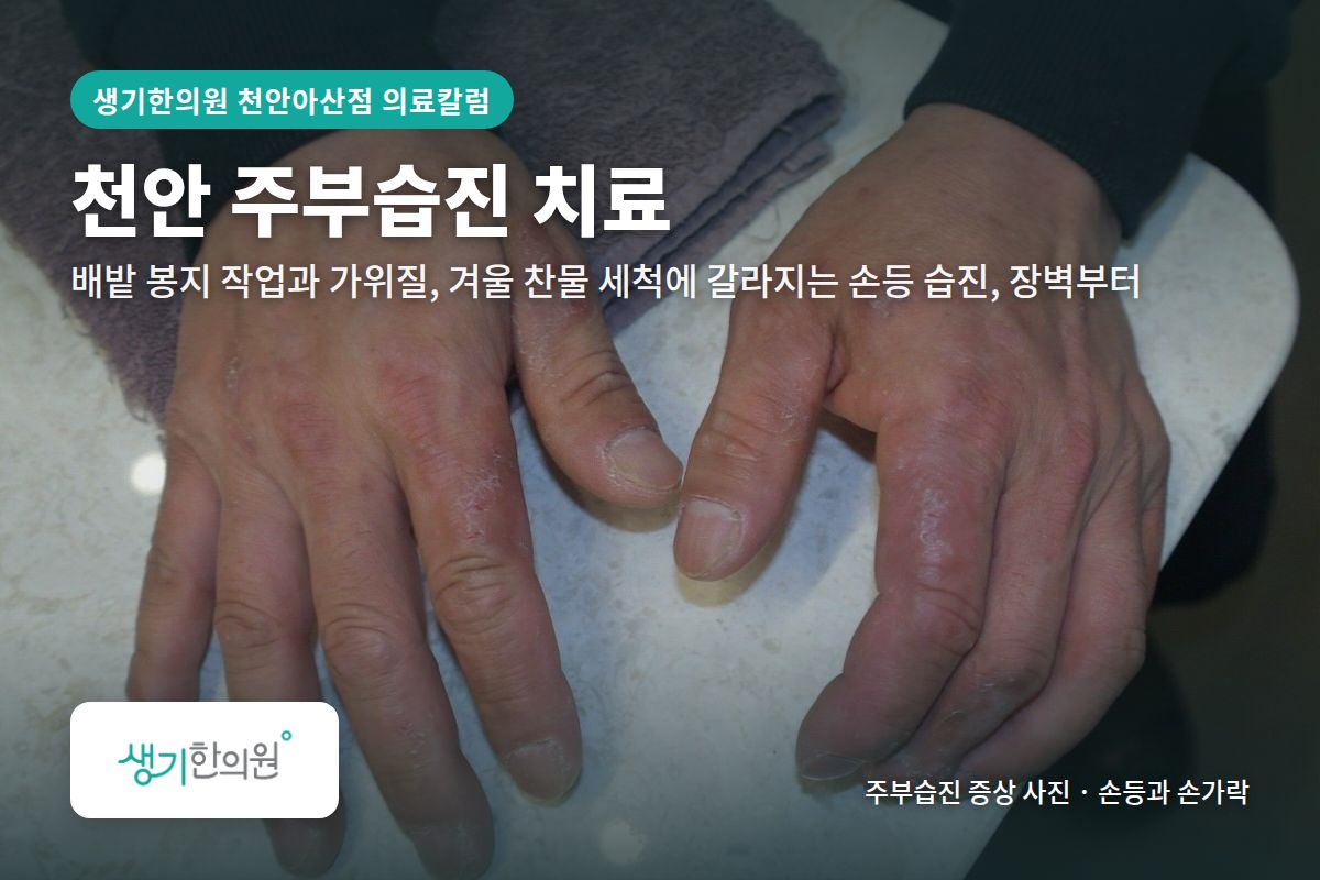 손등과 손가락 주부습진 증상 사진과 문구 「천안 주부습진 치료, 배밭 봉지 작업과 가위질, 겨울 찬물 세척에 갈라지는 손등 습진, 장벽부터 · 생기한의원 천안아산점」